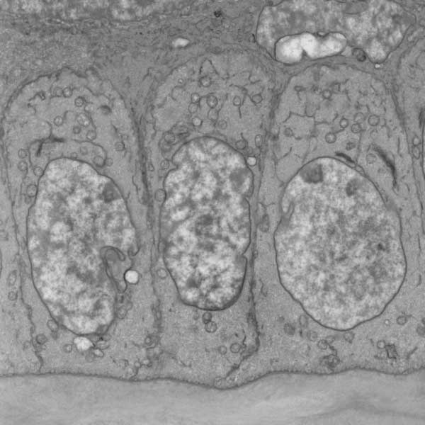 basal epithelial cells (left, SEM), 