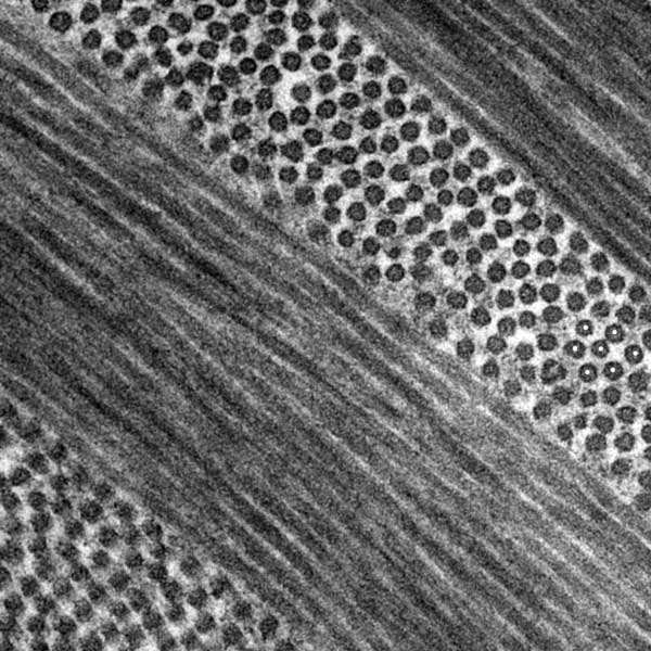 type I collagen fibrils organized into orthogonally arranged lamellae (middle, TEM)