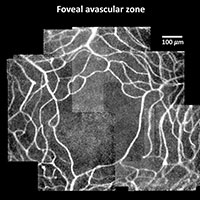 Biomedical Optics