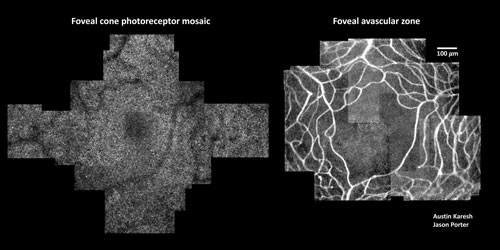 Biomedical Optics