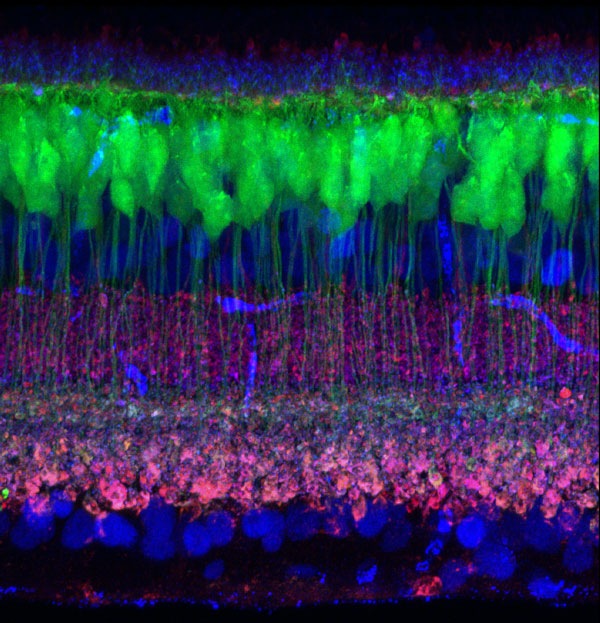 retina on bipolar cells